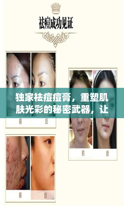 独家祛痘痘膏,重塑肌肤光彩的秘密武器,让你拥有无瑕美肌!