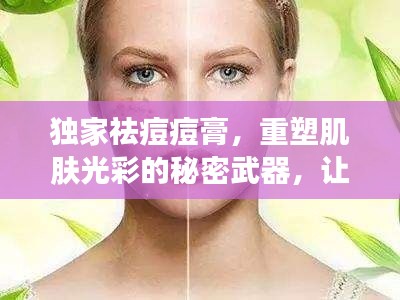 独家祛痘痘膏,重塑肌肤光彩的秘密武器,让你拥有无瑕美肌!